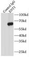 Equilibrative nucleoside transporter 1 antibody, FNab02778, FineTest, Immunoprecipitation image 