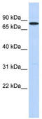 Probable ATP-dependent RNA helicase DDX41 antibody, TA341596, Origene, Western Blot image 