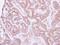 Neural EGFL Like 1 antibody, NBP2-19511, Novus Biologicals, Immunohistochemistry paraffin image 