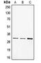 CD40 Molecule antibody, LS-C351964, Lifespan Biosciences, Western Blot image 