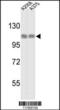 Hsp110 antibody, 61-557, ProSci, Western Blot image 