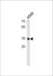 Rhox Homeobox Family Member 2B antibody, PA5-35225, Invitrogen Antibodies, Western Blot image 