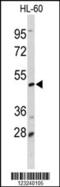 Decapping MRNA 2 antibody, MBS9203370, MyBioSource, Western Blot image 