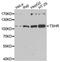 Thyroid Stimulating Hormone Receptor antibody, A6781, ABclonal Technology, Western Blot image 