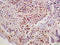 Cyclin B1 antibody, 251217, Abbiotec, Immunohistochemistry paraffin image 