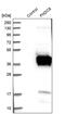 Fibronectin Type III Domain Containing 8 antibody, PA5-55329, Invitrogen Antibodies, Western Blot image 