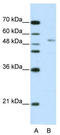 G-Rich RNA Sequence Binding Factor 1 antibody, TA345788, Origene, Western Blot image 