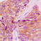 Janus Kinase 1 antibody, GTX55099, GeneTex, Immunohistochemistry paraffin image 