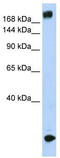 Sodium Voltage-Gated Channel Alpha Subunit 5 antibody, TA338380, Origene, Western Blot image 