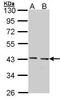 GULP PTB Domain Containing Engulfment Adaptor 1 antibody, TA308772, Origene, Western Blot image 