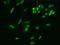 Dual Specificity Phosphatase 26 antibody, 201800-T02, Sino Biological, Immunohistochemistry paraffin image 