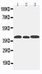C-C Motif Chemokine Receptor 5 (Gene/Pseudogene) antibody, GTX12309, GeneTex, Western Blot image 