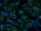 Sorting nexin-9 antibody, M03796, Boster Biological Technology, Immunofluorescence image 