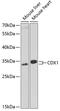 Homeobox protein CDX-1 antibody, A04522, Boster Biological Technology, Western Blot image 