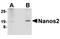Nanos C2HC-Type Zinc Finger 2 antibody, orb75007, Biorbyt, Western Blot image 