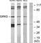 G Protein-Coupled Receptor Kinase 5 antibody, TA312217, Origene, Western Blot image 