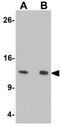 HIG1 Hypoxia Inducible Domain Family Member 1A antibody, GTX16279, GeneTex, Western Blot image 