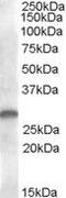 C-type lectin domain family 1 member B antibody, PA5-18938, Invitrogen Antibodies, Western Blot image 