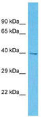 Olfactory Receptor Family 2 Subfamily M Member 2 antibody, TA337492, Origene, Western Blot image 