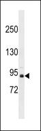 Zinc Finger And BTB Domain Containing 49 antibody, LS-C157395, Lifespan Biosciences, Western Blot image 