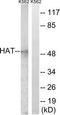 Histone Acetyltransferase 1 antibody, TA311666, Origene, Western Blot image 