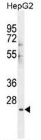 Putative inactive carboxylesterase 4 antibody, AP50869PU-N, Origene, Western Blot image 