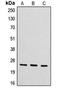 Cytochrome B561 Family Member D2 antibody, LS-C353301, Lifespan Biosciences, Western Blot image 