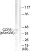 C-C Motif Chemokine Receptor 5 (Gene/Pseudogene) antibody, PA5-38243, Invitrogen Antibodies, Western Blot image 