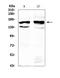 Formin 1 antibody, A07520, Boster Biological Technology, Western Blot image 