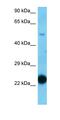 Ankyrin Repeat Domain 36B antibody, orb326798, Biorbyt, Western Blot image 