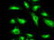 Cancer/testis antigen 1 antibody, GTX84651, GeneTex, Immunofluorescence image 