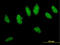 Ubiquitin carboxyl-terminal hydrolase CYLD antibody, LS-C197008, Lifespan Biosciences, Immunofluorescence image 