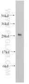 Charged multivesicular body protein 1b antibody, 14639-1-AP, Proteintech Group, Western Blot image 