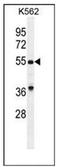 Growth Differentiation Factor 9 antibody, AP51813PU-N, Origene, Western Blot image 