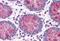 Aspartyl-TRNA Synthetase antibody, MBS245891, MyBioSource, Immunohistochemistry paraffin image 
