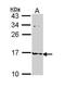 Fatty Acid Binding Protein 4 antibody, PA5-30591, Invitrogen Antibodies, Western Blot image 