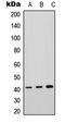 P2Y purinoceptor 4 antibody, LS-B14493, Lifespan Biosciences, Western Blot image 
