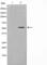 LYN Proto-Oncogene, Src Family Tyrosine Kinase antibody, abx011098, Abbexa, Western Blot image 