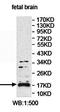 Eukaryotic Translation Elongation Factor 1 Epsilon 1 antibody, orb78251, Biorbyt, Western Blot image 