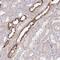 5'-Nucleotidase, Cytosolic IA antibody, NBP2-48604, Novus Biologicals, Immunohistochemistry frozen image 