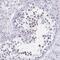 Coiled-Coil Domain Containing 105 antibody, PA5-63588, Invitrogen Antibodies, Immunohistochemistry frozen image 