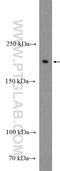 Neurofascin antibody, 26351-1-AP, Proteintech Group, Western Blot image 
