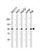 SLC22A2 antibody, M01612, Boster Biological Technology, Western Blot image 