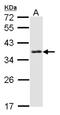 Survival Of Motor Neuron 2, Centromeric antibody, NBP1-32021, Novus Biologicals, Western Blot image 