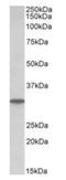Purine Nucleoside Phosphorylase antibody, orb99062, Biorbyt, Western Blot image 