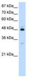 Polyadenylate-binding protein-interacting protein 1 antibody, TA345966, Origene, Western Blot image 