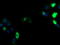 Zinc Finger And SCAN Domain Containing 18 antibody, LS-C174162, Lifespan Biosciences, Immunofluorescence image 