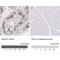 Anillin antibody, NBP2-52907, Novus Biologicals, Immunohistochemistry paraffin image 