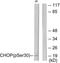 DNA Damage Inducible Transcript 3 antibody, TA312978, Origene, Western Blot image 