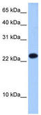 Eukaryotic Translation Initiation Factor 4E Family Member 3 antibody, TA344020, Origene, Western Blot image 